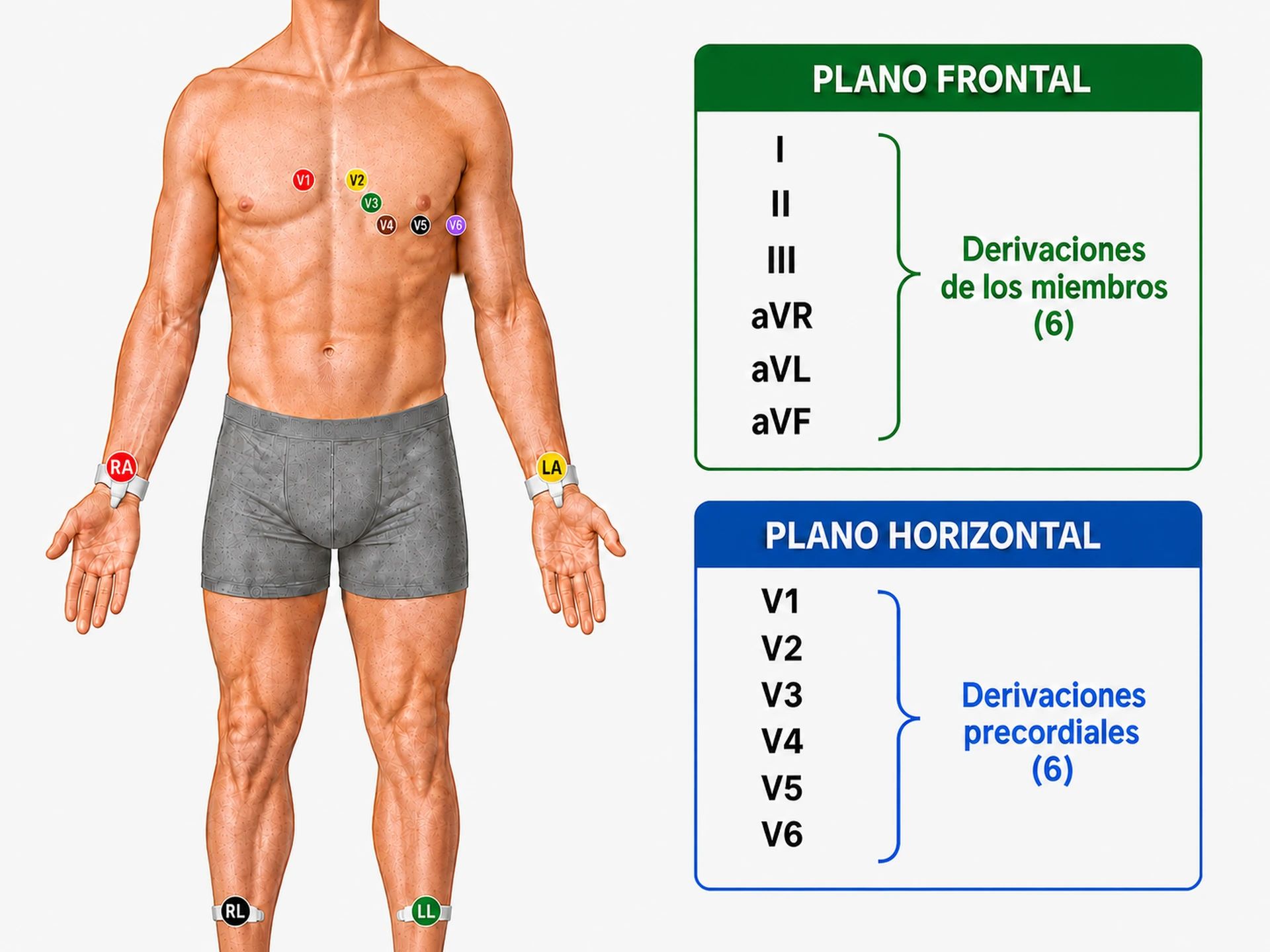 Diez electrodos del ECG estándar con colores IEC y las doce derivaciones