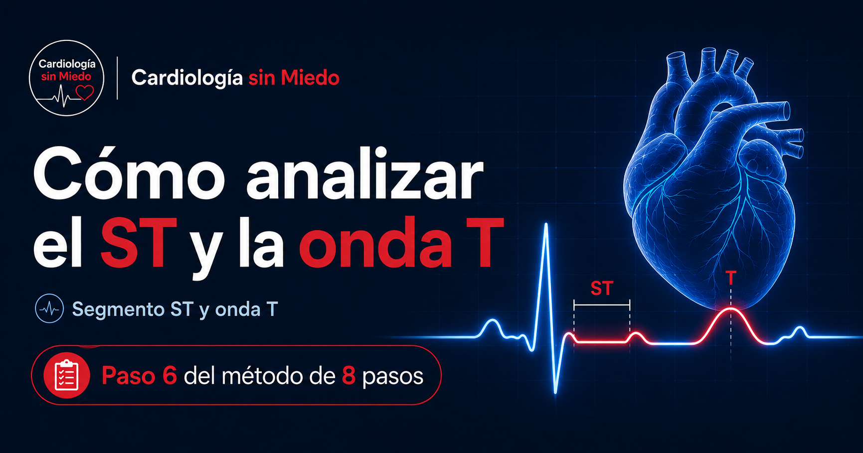 Paso 6 del método de 8 pasos de Cardiología sin Miedo: análisis del segmento ST y la onda T en el ECG