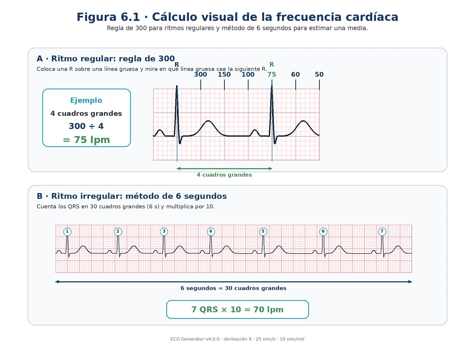 Cómo calcular la frecuencia cardíaca en el ECG con la regla 300 150 100 75 60 50 y el método de 6 segundos