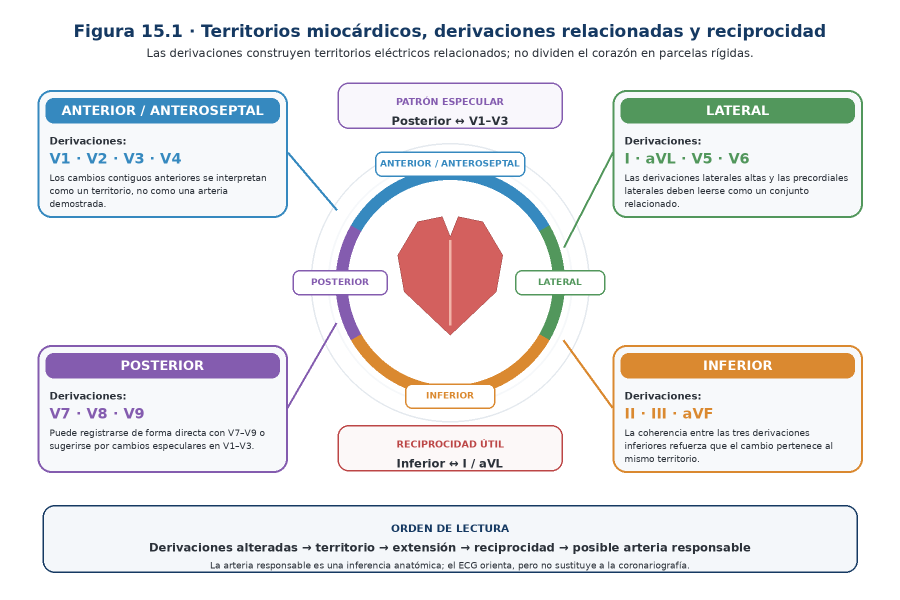 Esquema de territorios electrocardiográficos inferior anterior lateral posterior y ventrículo derecho con sus derivaciones